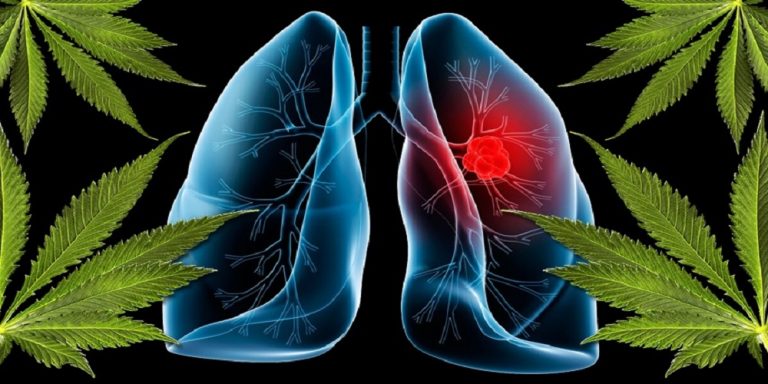 CBD pentru cancerul pulmonar – Ce știm până acum!